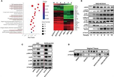 Divergent EGFR/MAPK-Mediated Immune Responses to Clinical Candida Pathogens in Vulvovaginal Candidiasis